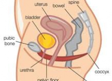 Rối loạn chức năng sàn chậu nữ